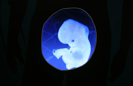 The logical slippery slope to human embryo factories begins with surrogacy and gamete sales