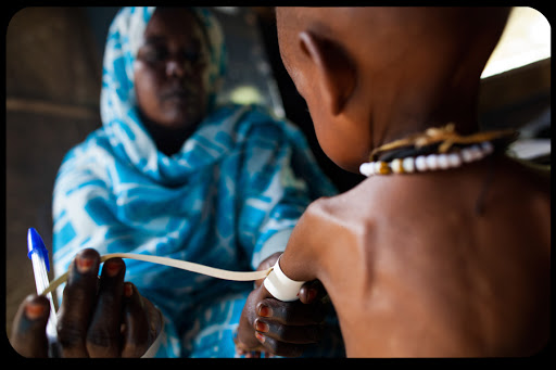 Nigeria &#8211; Amid the wealth of oil, children die of malnutrition
