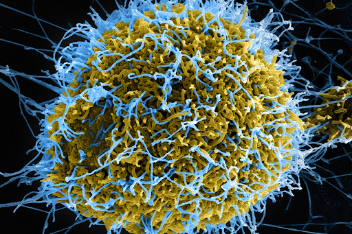 Ebola Virus 02