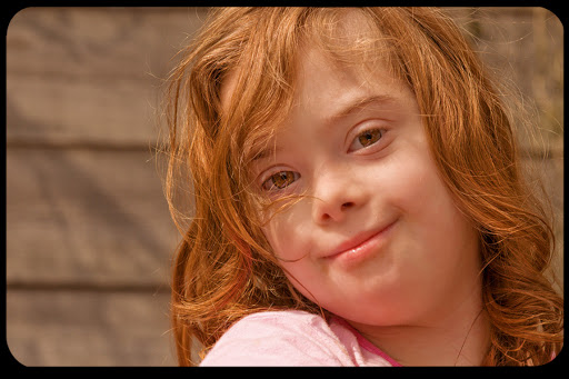 WEB Girl Downs Syndrome Andrea CC