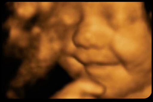 WEB-Unborn-Smile-Ultrasound-Life-Live-Action-News-via-MEN-Syndication