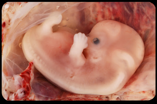 WEB-Human-Embryo-Ed-Uthman-CC