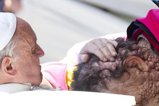 Pope Francis embraces disfigured Vicinio Rivas