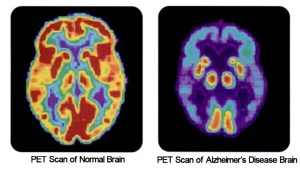 BRAIN SCAN