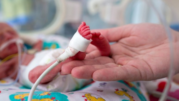 PREMATURE BABY
