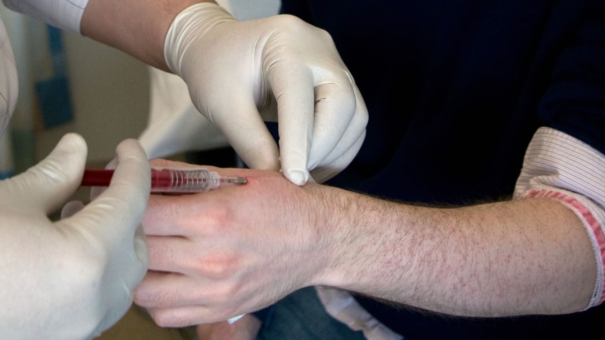 RFID,MICROCHIP,IMPLANT