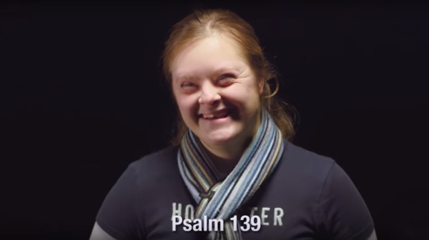 DOWN SYNDROME,PSALM 139