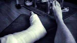 BROKEN ANKLE