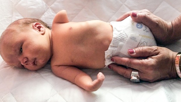 Baby Forrest without Limbs