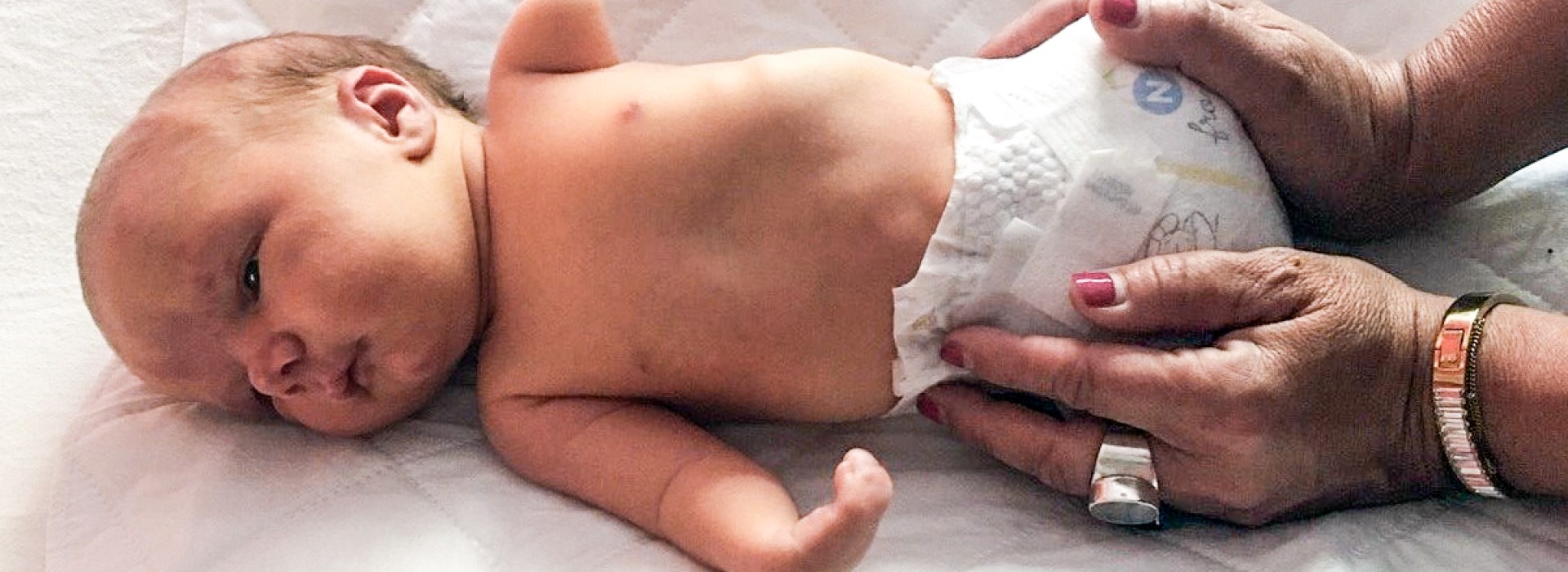 Baby Forrest without Limbs