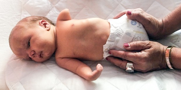 After Her Baby Was Born Without Limbs A Mother Witnessed A Miracle
