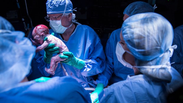 Baby Born Uterus Transplant