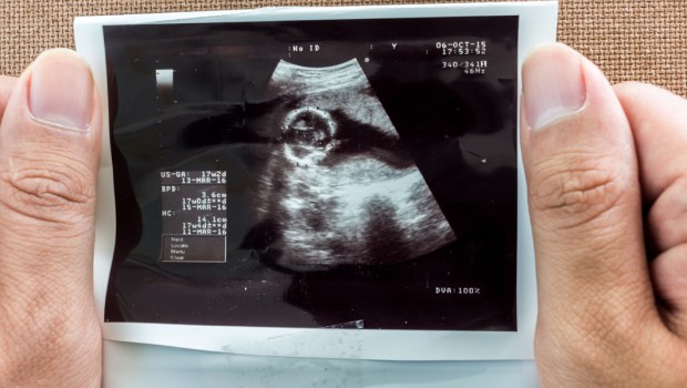 MAN,ULTRASOUND