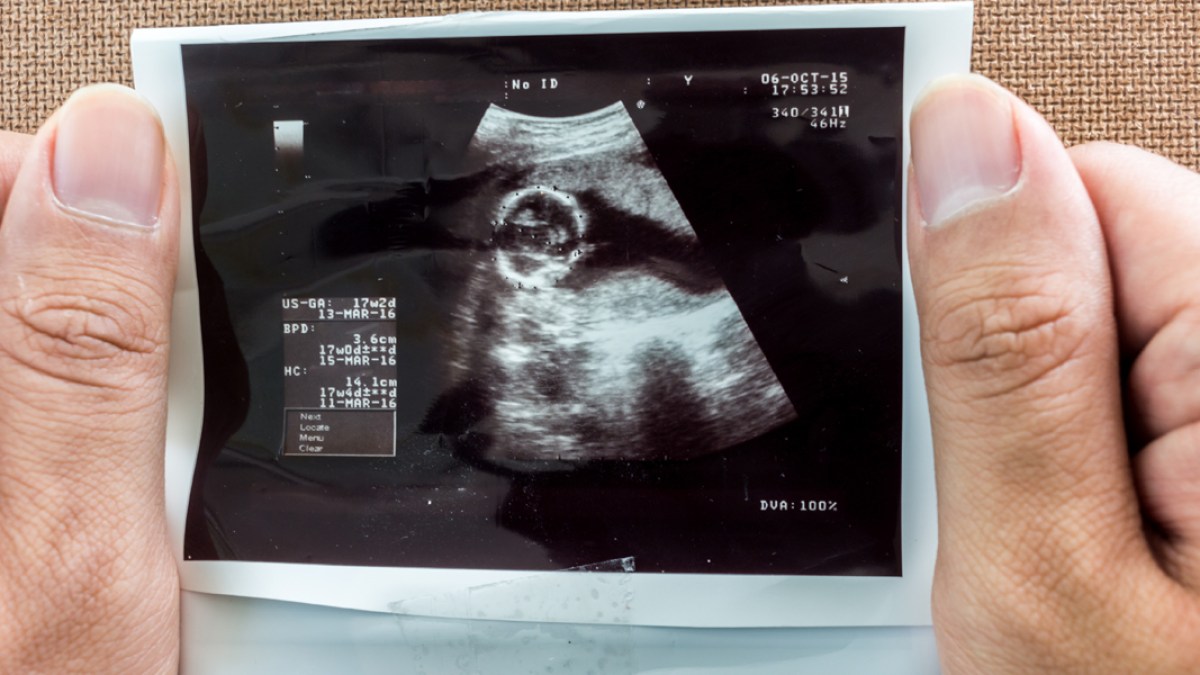 MAN,ULTRASOUND