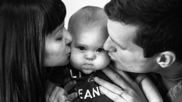 DOWN SYNDROME BABY WITH PARENTS