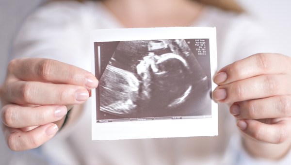 Corner Item Image - Pope backs “spiritual adoption of the unborn”