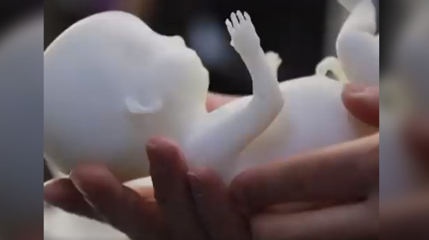 FETAL,MODEL,3D