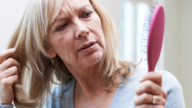 WOMAN LOSING HAIR