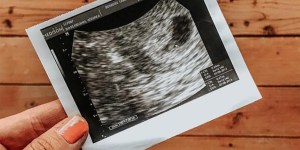 Women everywhere shared heartbreaking stories this week about pregnancy and infant loss