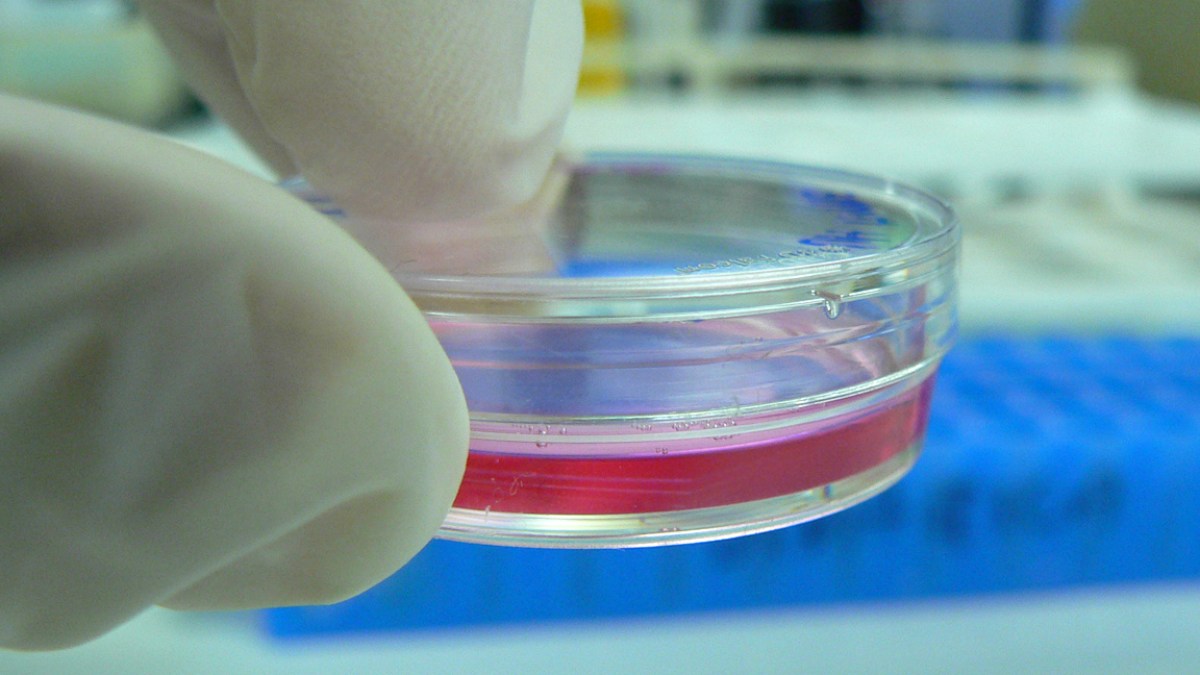 cell_culture_in_a_tiny_petri_dish.jpg