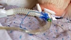 VENTILATOR, TRACHEOSTOMY,