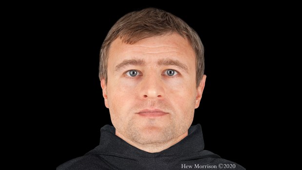 FORENSIC FACIAL RECONSTRUCTION