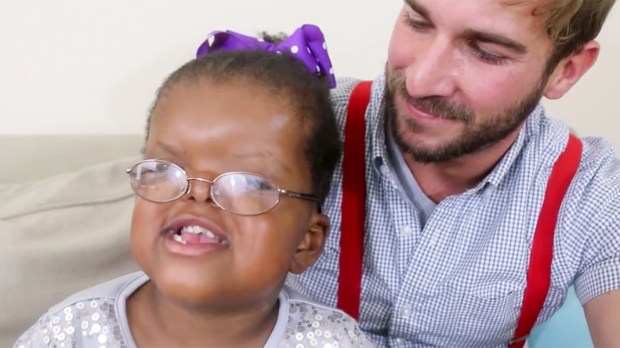 LOLA'S LIFE WITH APERT SYNDROME