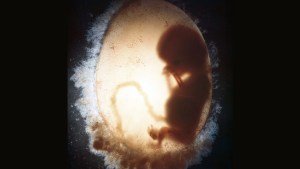embryo fetus light uterus dark