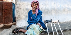 Leprosy still exists today, as do the Catholics who serve the afflicted