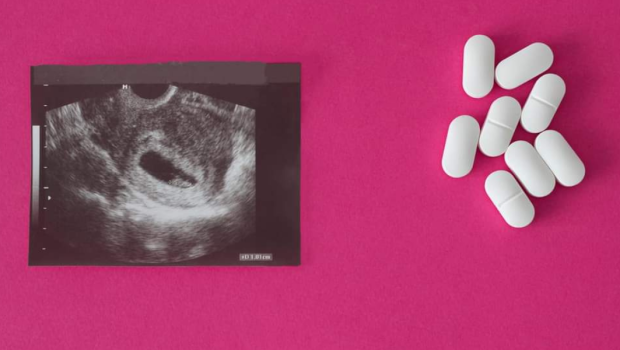 Aborto