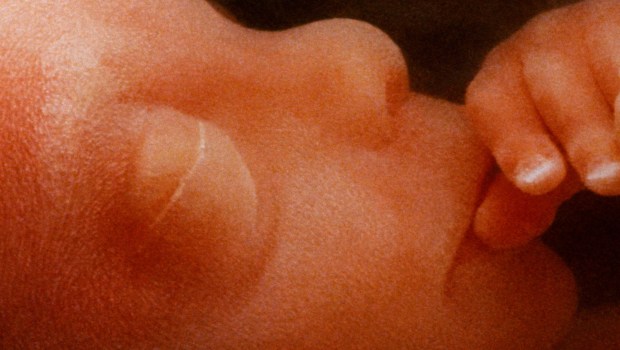 FETUS
