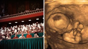 WEB3-SECOND-VATICAN-ULTRASOUND-ABORTION-Wiki-Shutterstock.jpg