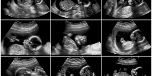 A nun&#8217;s research reveals &#8216;prophet&#8217; of the pro-life movement