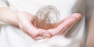 The fantastic way dads and sons support 7th grader with alopecia