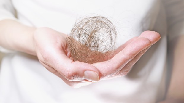 Ball-of-hair-on-a-womans-hand