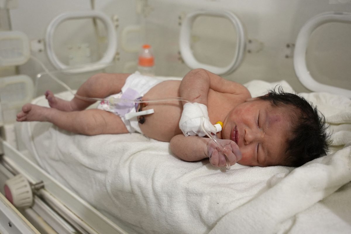 BABY-SYRIA-AFP-000_338P8AK.jpg
