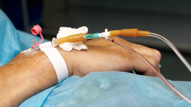 Patient with IV in hand