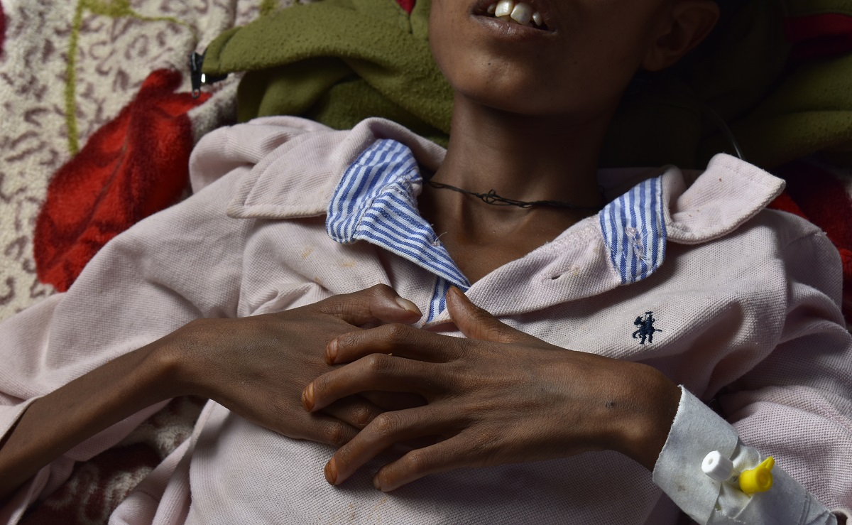 Ethiopia starvation