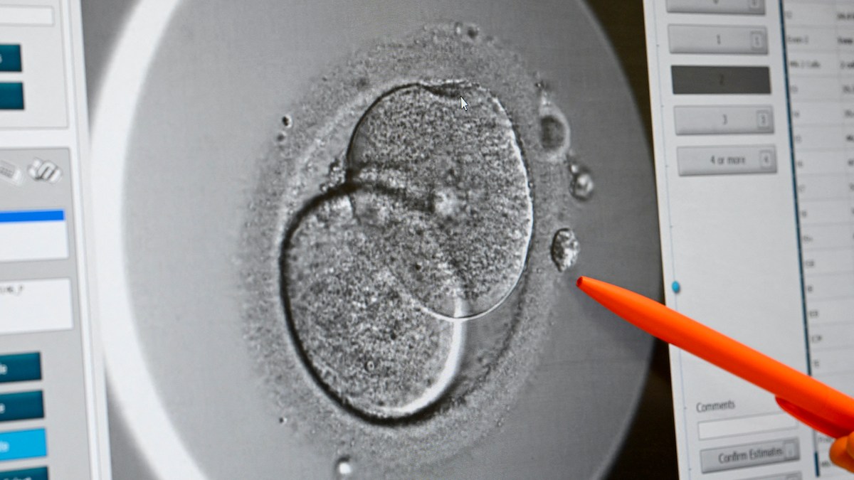 IVF IN PROGRESS