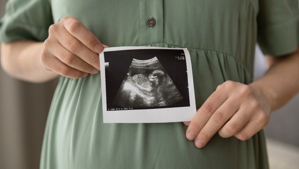 pregnancy ultrasound