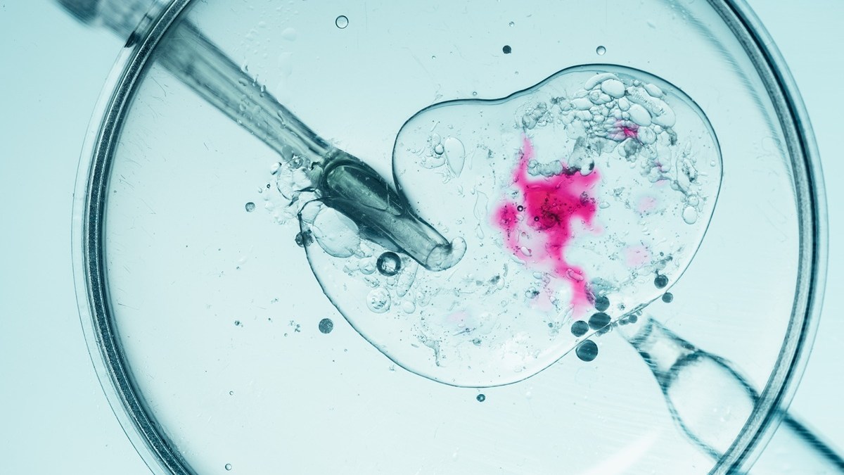 in vitro fertilization