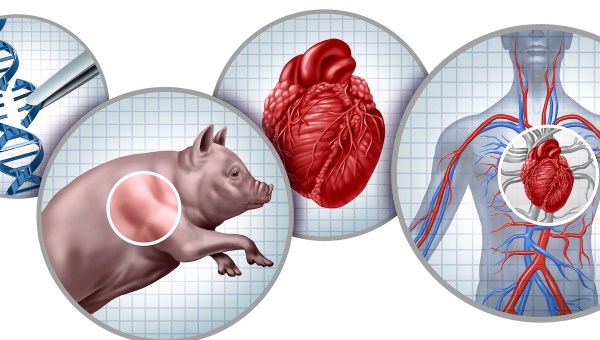 Corner Item Image - Holy See refines guidelines on animal-to-human transplants